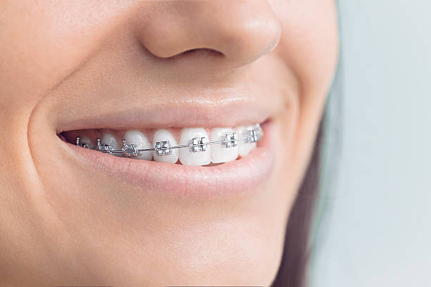 Best Traditional Braces  in La Selva Beach, CA